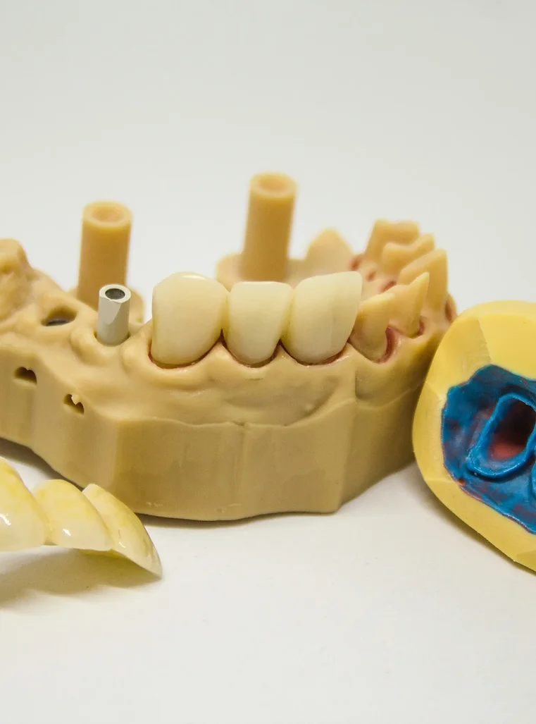 Dental Bridge Tools