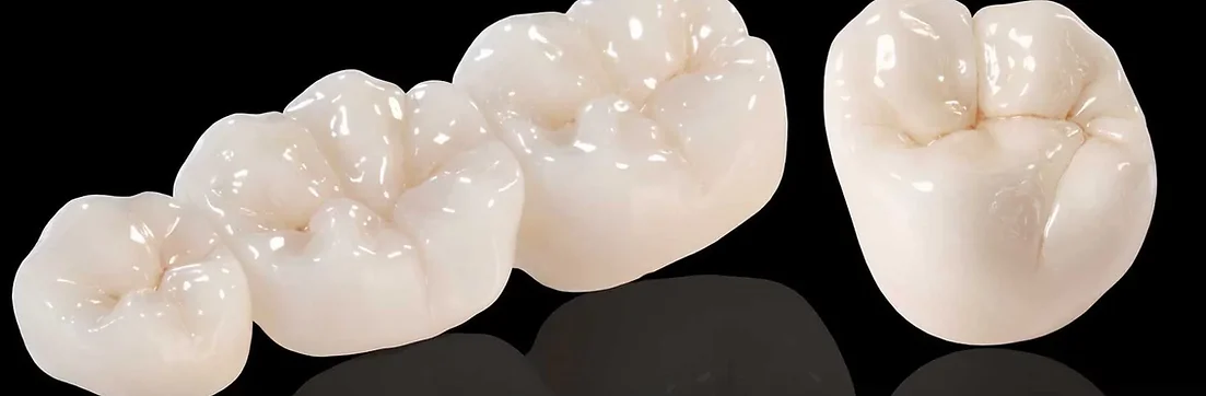 Dental Crowns Sample