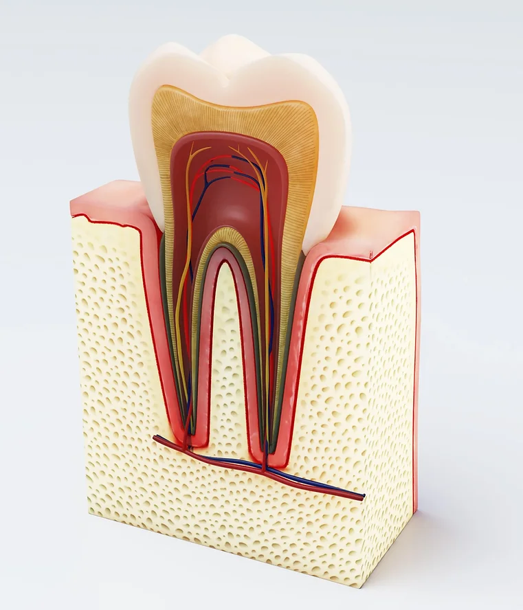 Dental Fillings Model