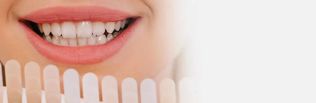 Zoom Teeth Whitening