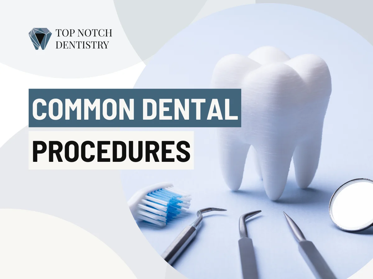 TNDD - Common Dental Procedures